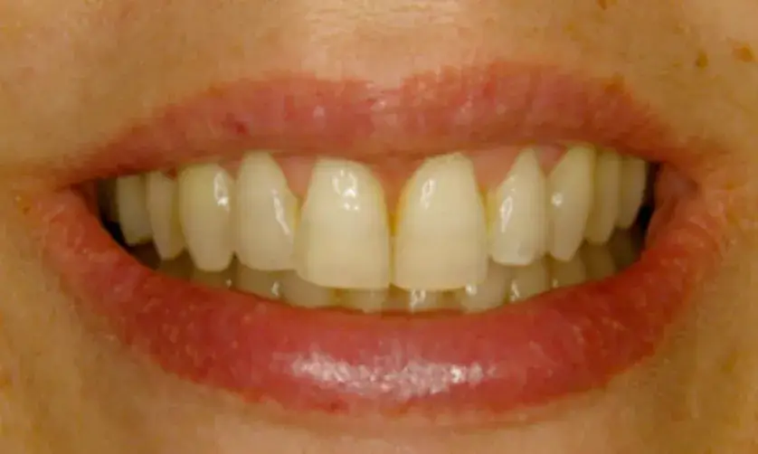 Close-up of a person smiling, showing their teeth and lips.