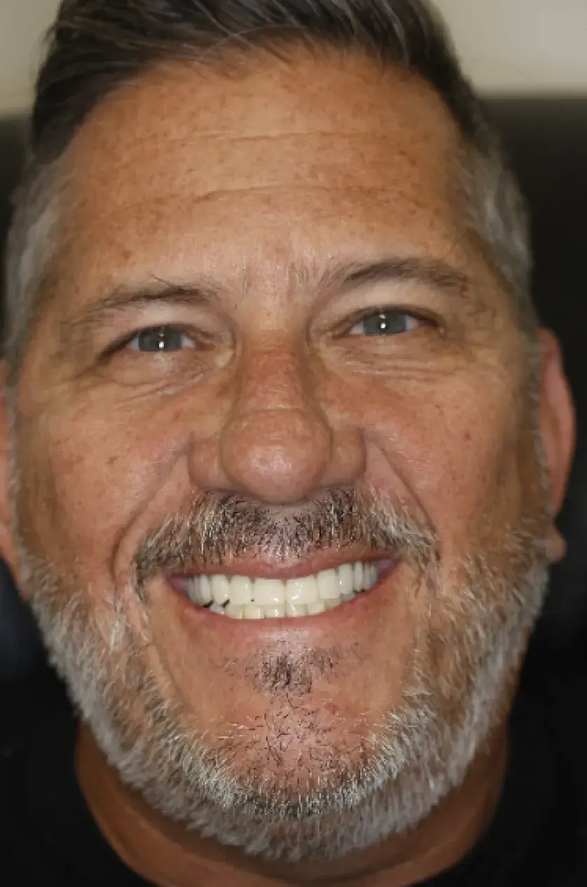A man with a beard smiling broadly at the camera.