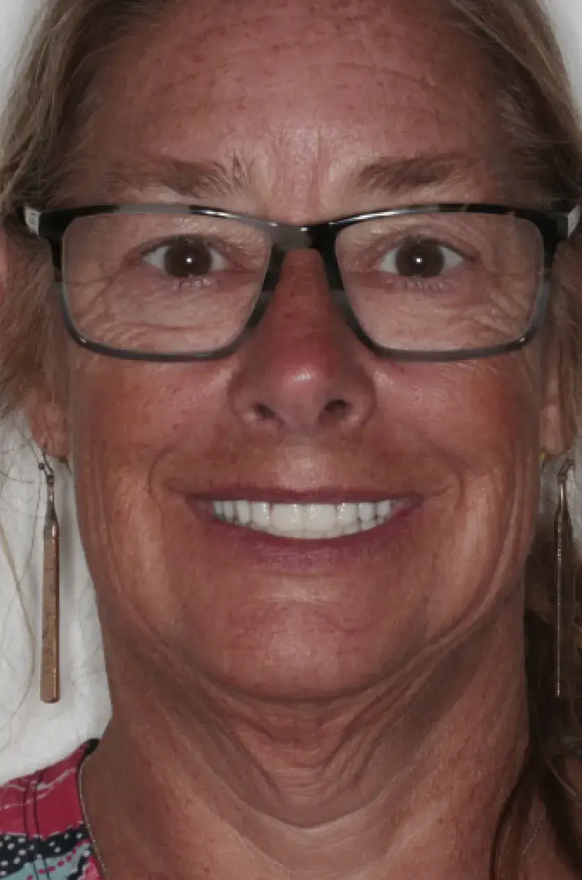 A person is smiling, wearing glasses and long earrings, with brown hair pulled back.