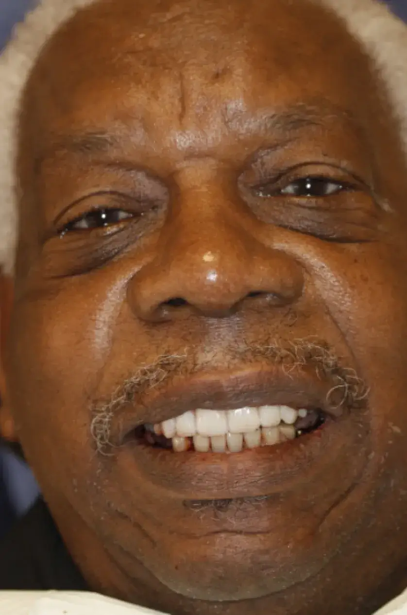 An elderly man with gray hair smiles warmly, showing his teeth.