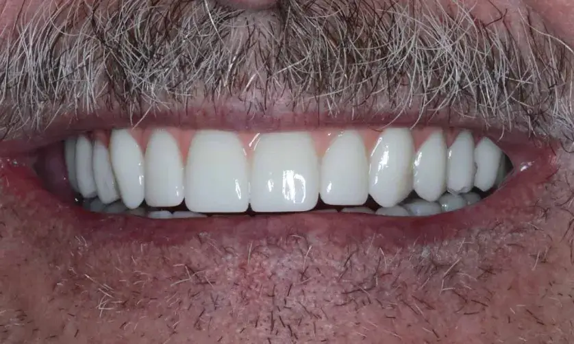 A close-up of a man smiling, showing his white teeth and mustache.