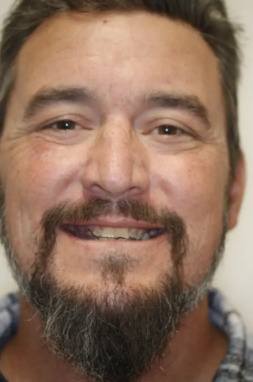 A man with a beard and mustache is smiling at the camera.