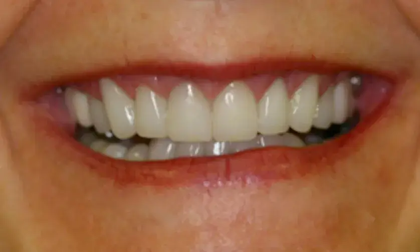 A close-up of a person's smiling mouth showing teeth and lips.