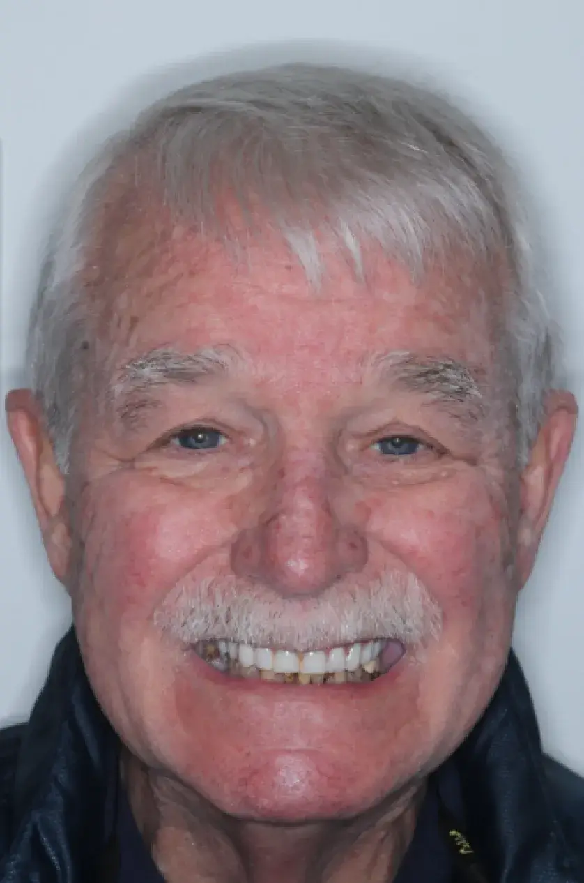 Elderly man with white hair smiling directly at the camera.