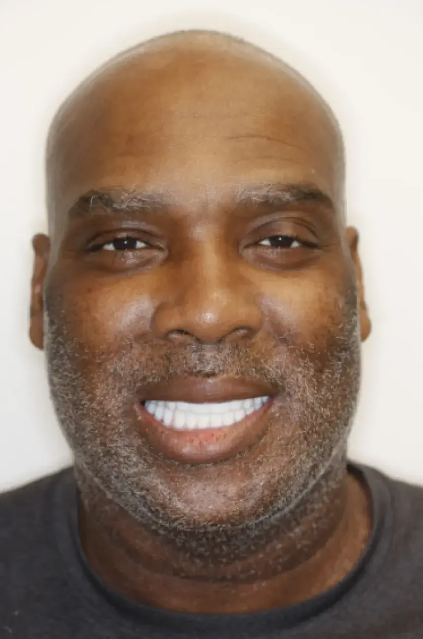 A bald man with a gray beard is smiling at the camera against a plain background.