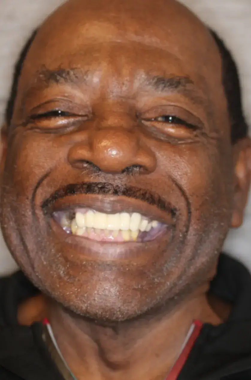 Smiling man with a mustache, wearing a dark jacket, showing white teeth.