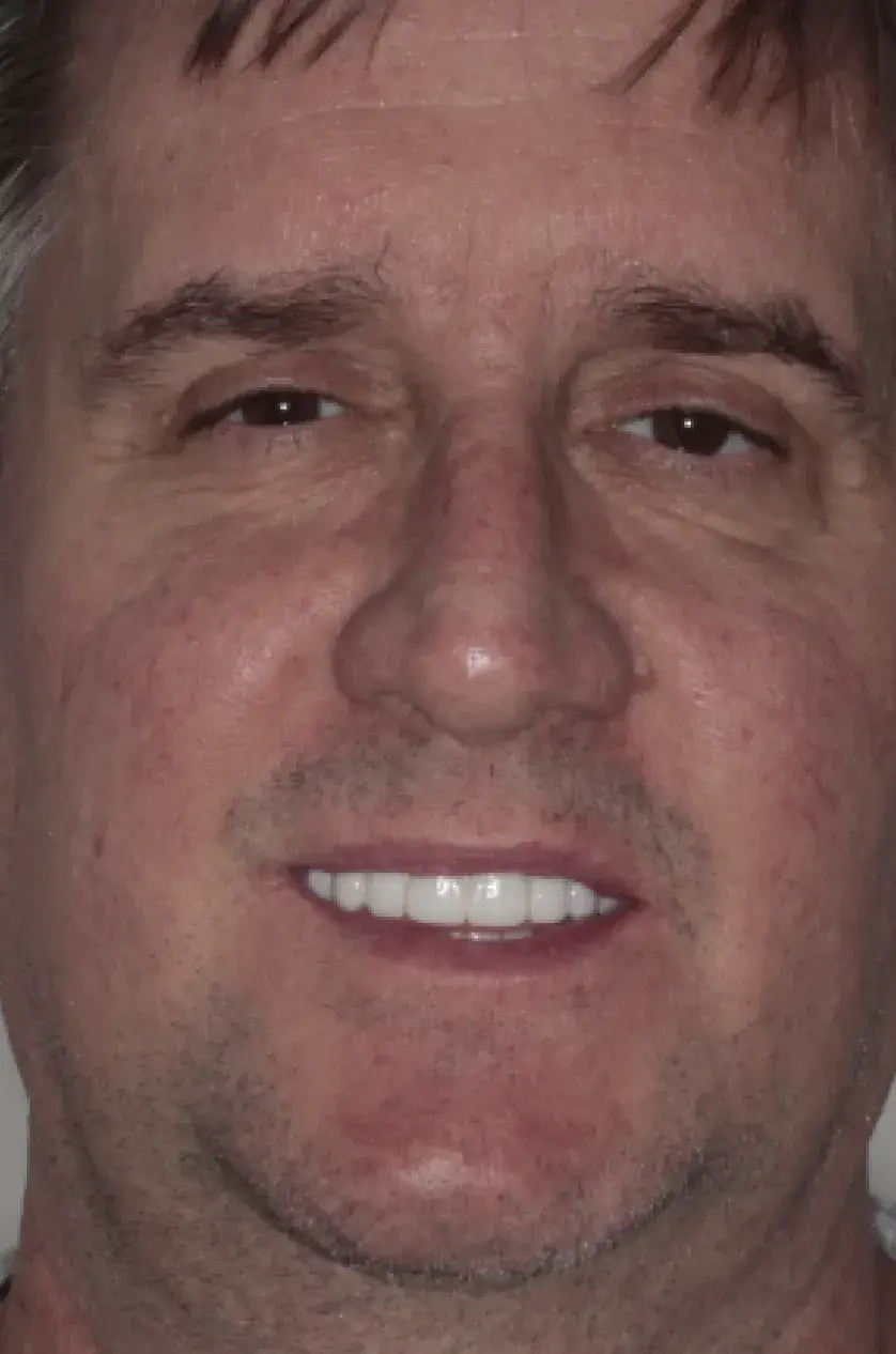 A person smiling directly at the camera.