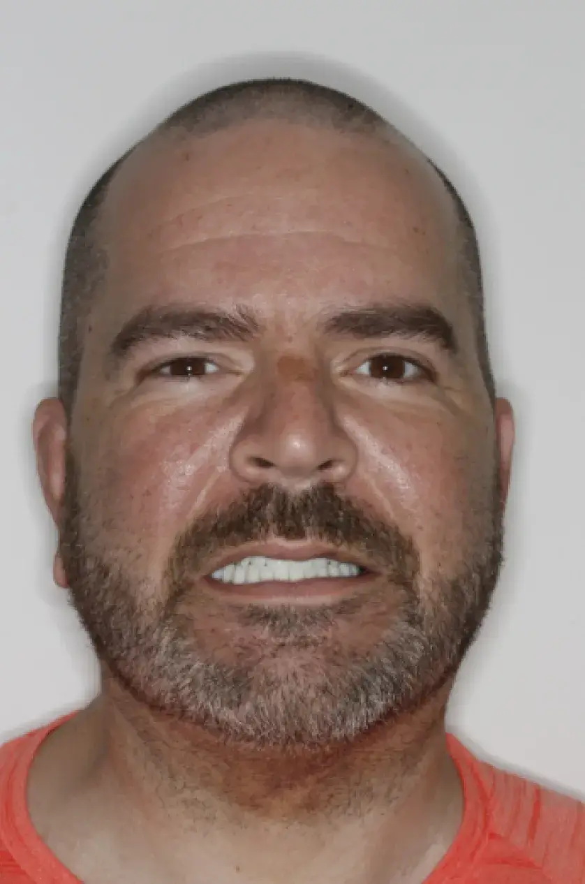 A person with a beard and short hair is smiling, wearing an orange shirt.