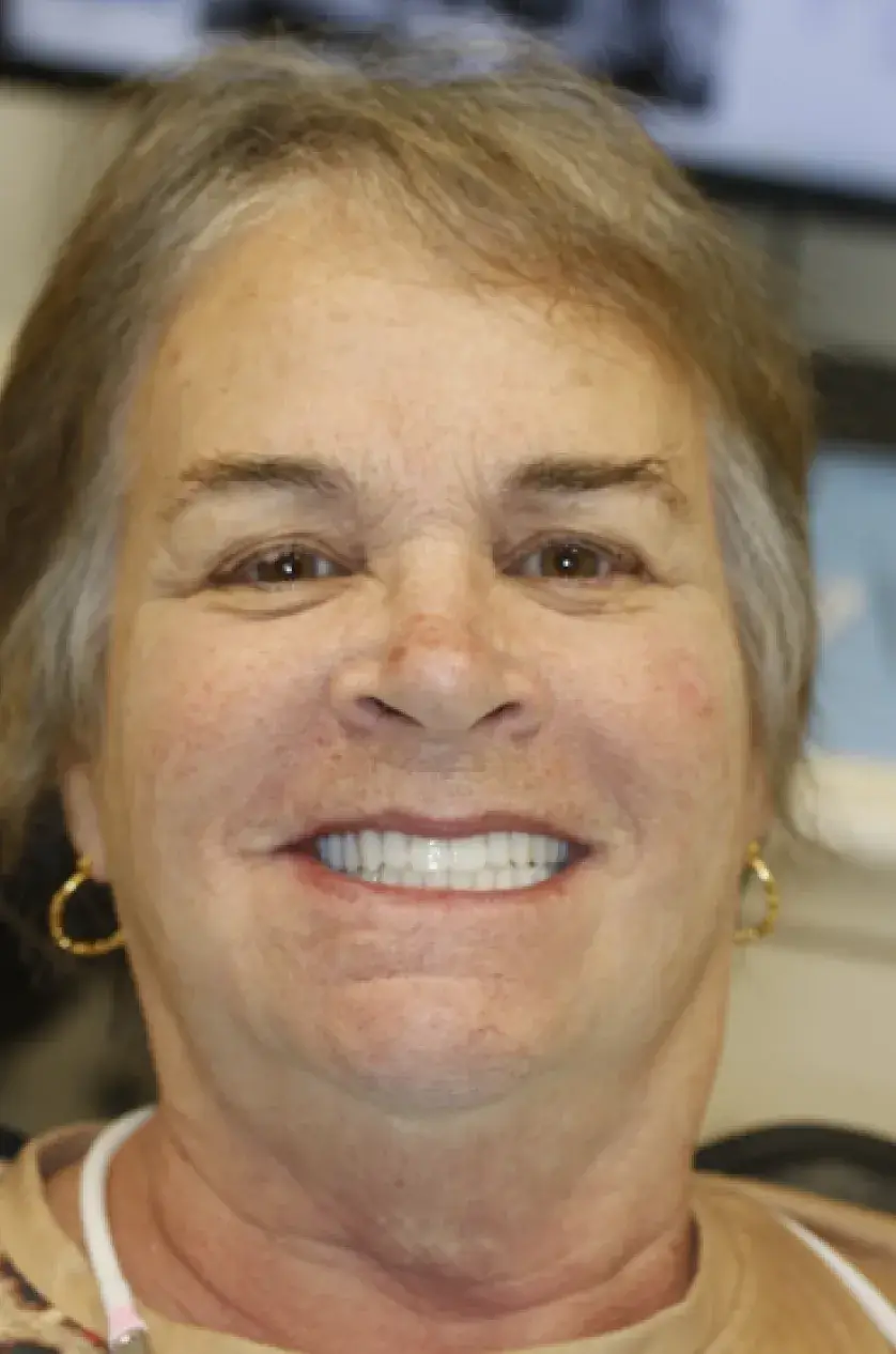 A woman with short hair is smiling broadly, showing her teeth.