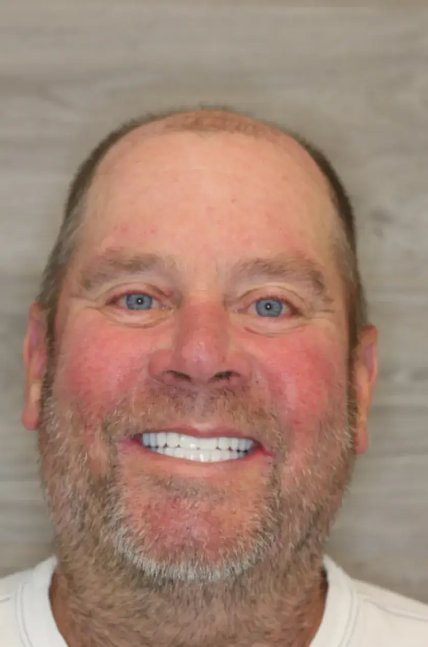 Smiling man with a beard wearing a white shirt against a plain background.