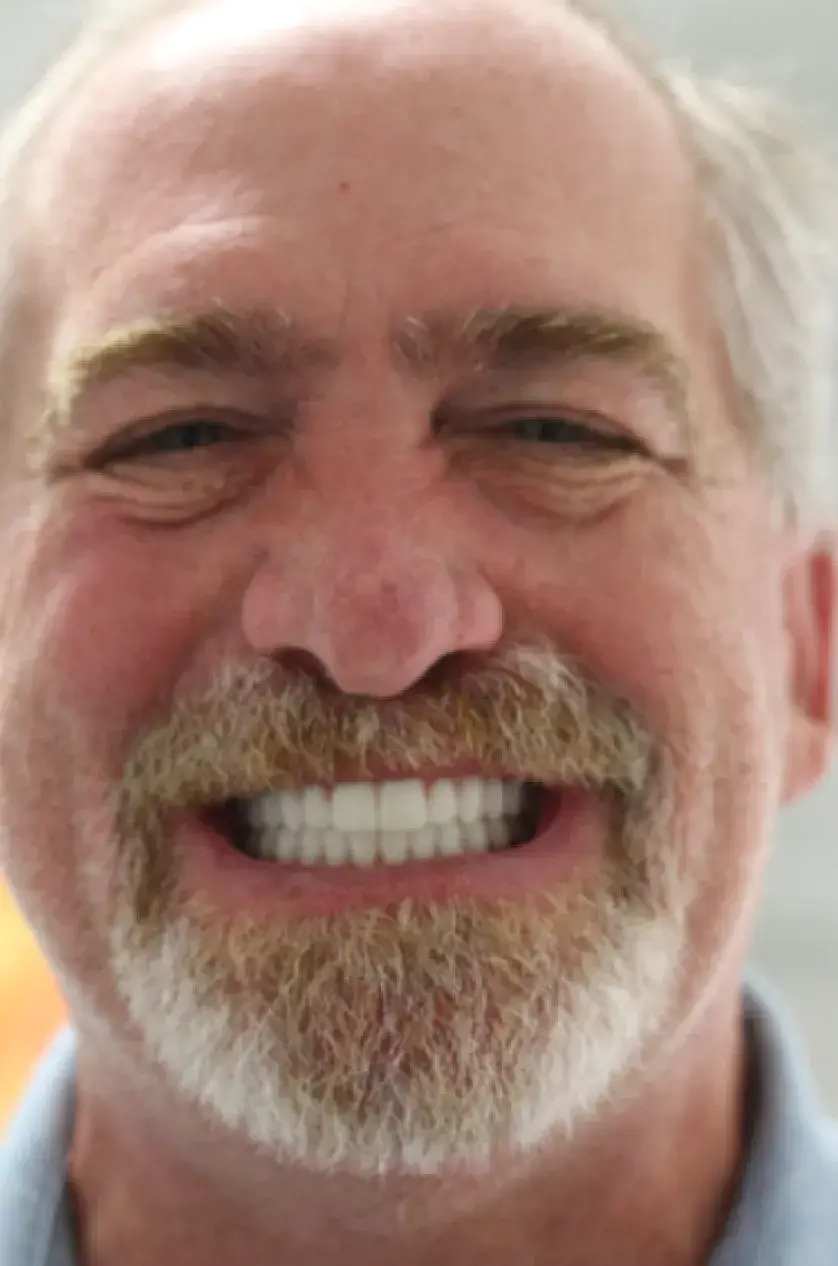 A man smiling broadly, showing his teeth, with a gray beard and short hair.
