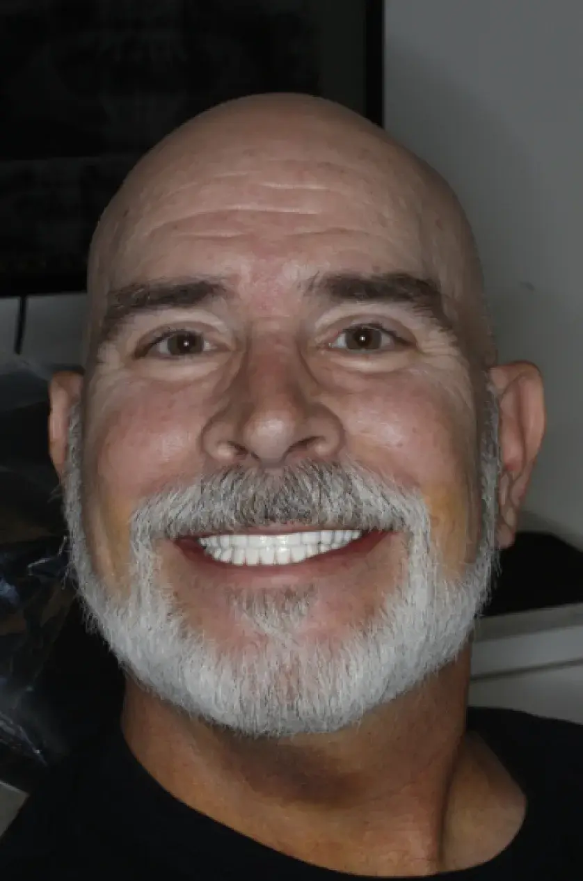 A man with a shaved head and beard smiles directly at the camera.
