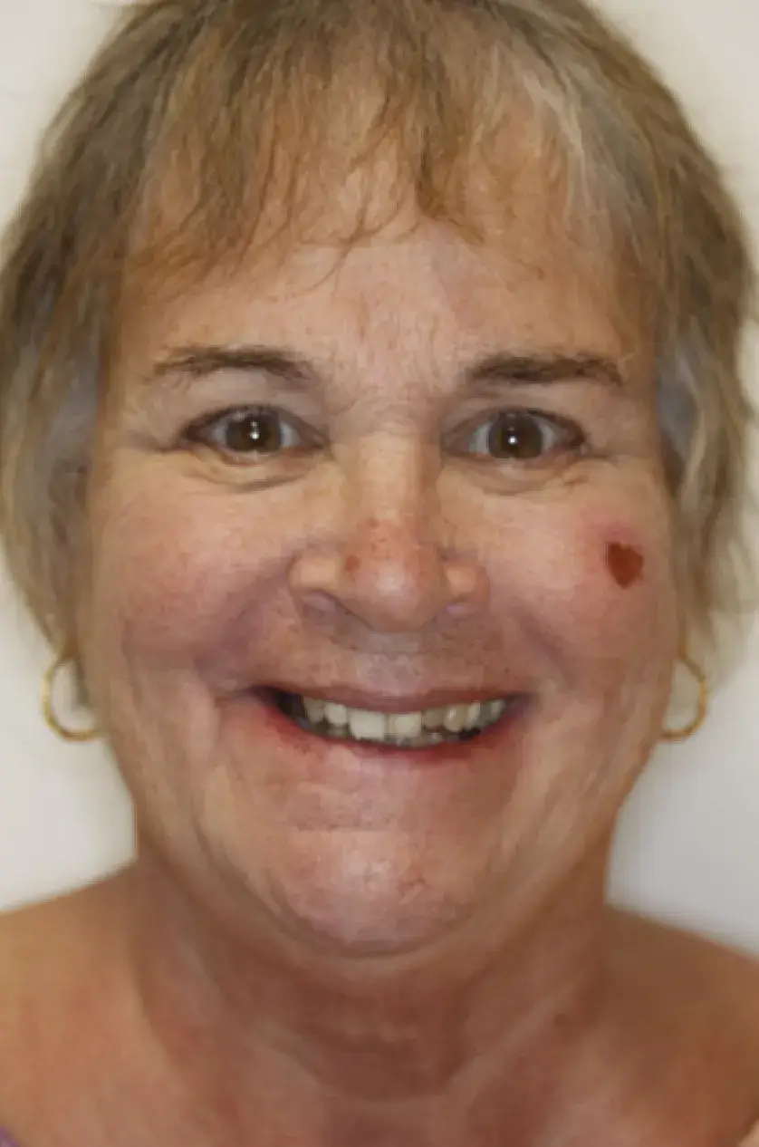Smiling woman with short hair and a heart-shaped mark on her cheek.