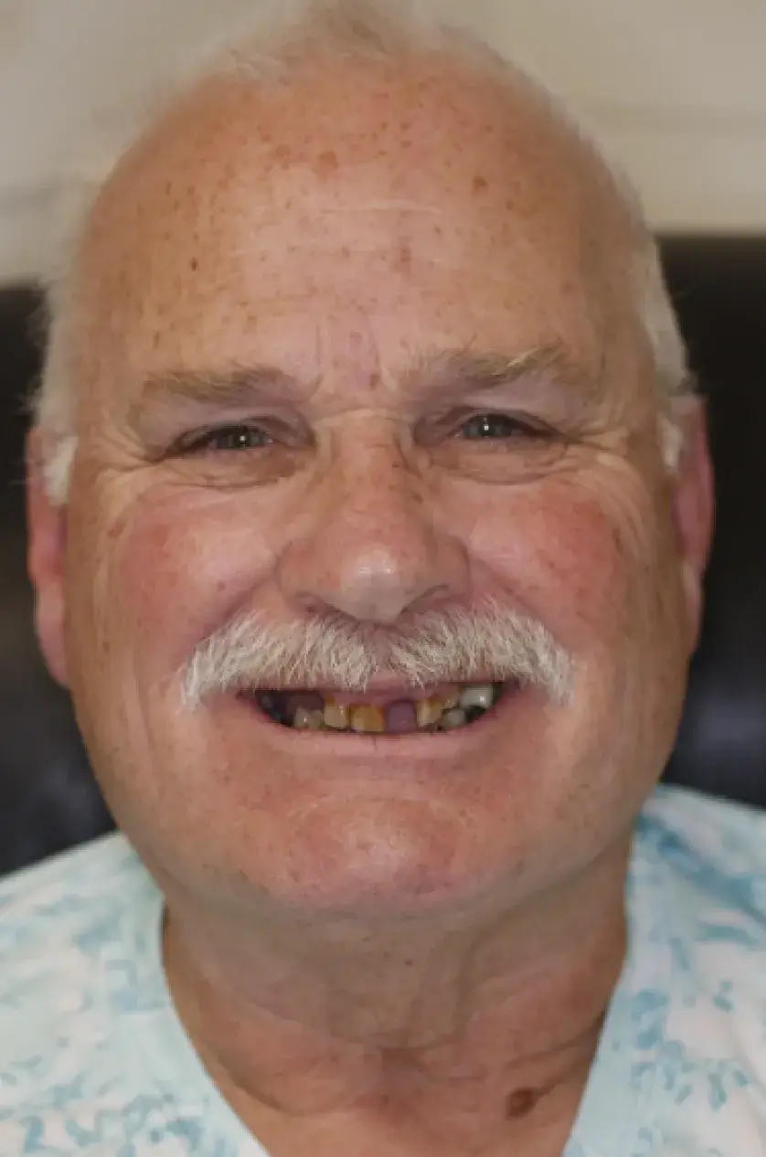 A smiling older man with a mustache and missing tooth, sitting on a dark chair.