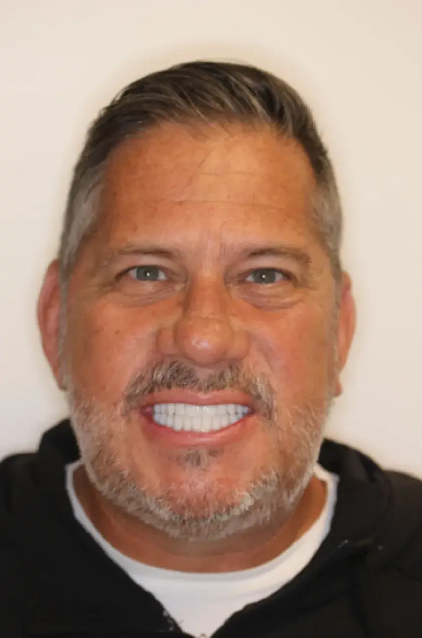 A man with short hair smiling widely, showing his teeth, against a plain background.