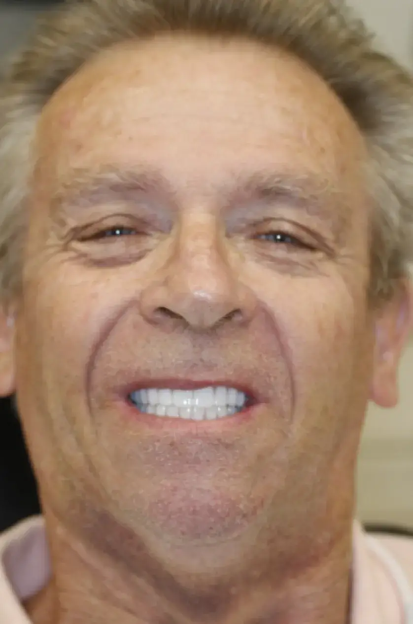 A man smiling broadly, showing his teeth clearly.