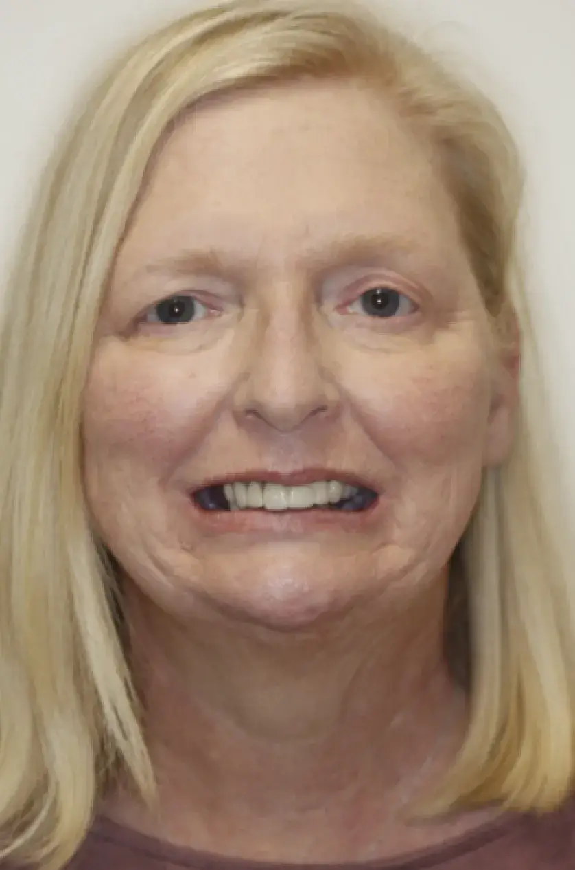 A woman with blonde hair is smiling at the camera.