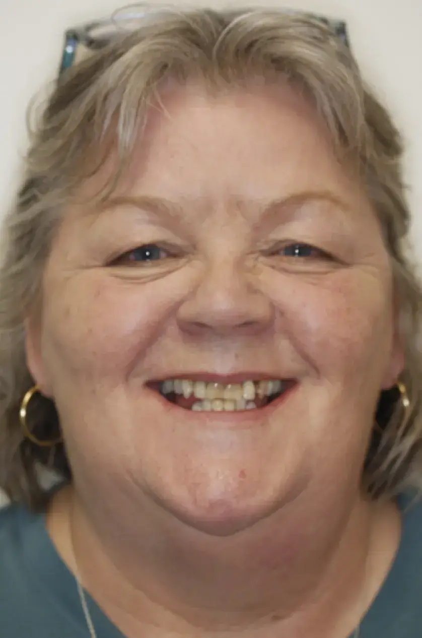 Woman smiling with short, light-colored hair and wearing hoop earrings.
