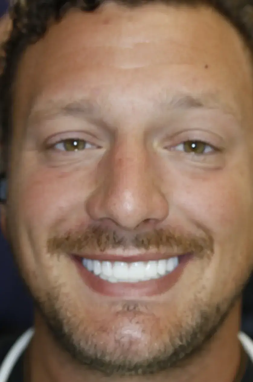 Smiling person with short curly hair and a mustache, showing bright white teeth.