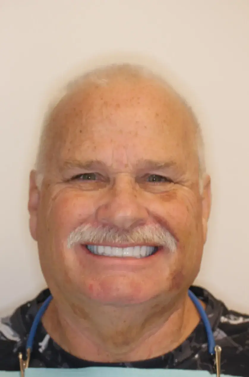 Smiling man with a white mustache against a plain background, wearing a patterned shirt and lanyard.