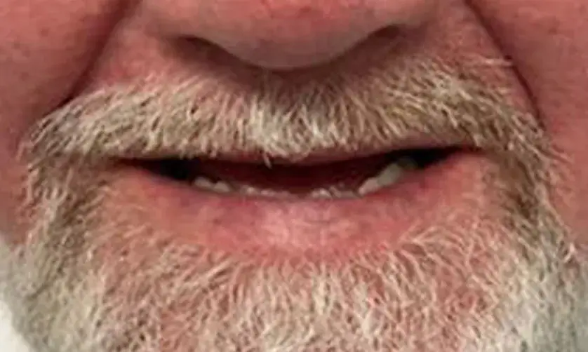 Close-up of an elderly man's face, showing a white mustache and beard.