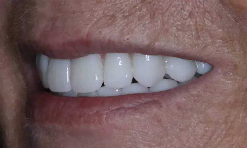 Person smiling, showing a set of white teeth against a close-up of their lips and skin.