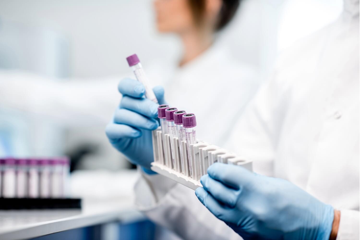 A lab technician wearing blue gloves and a white coat handles a rack of blood sample vials with purple caps in a medical laboratory setting.