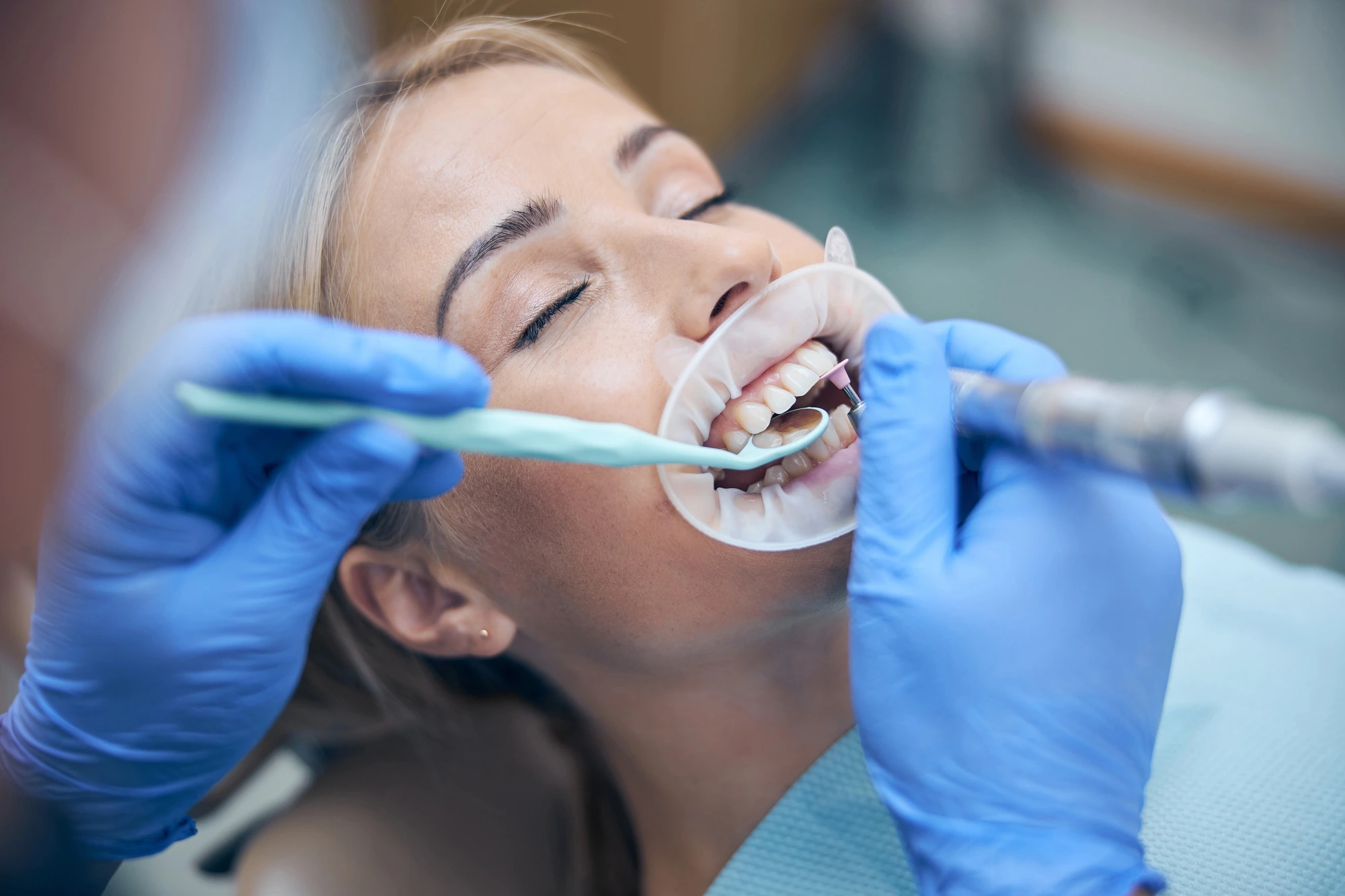 girl getting sedation dentistry in davie