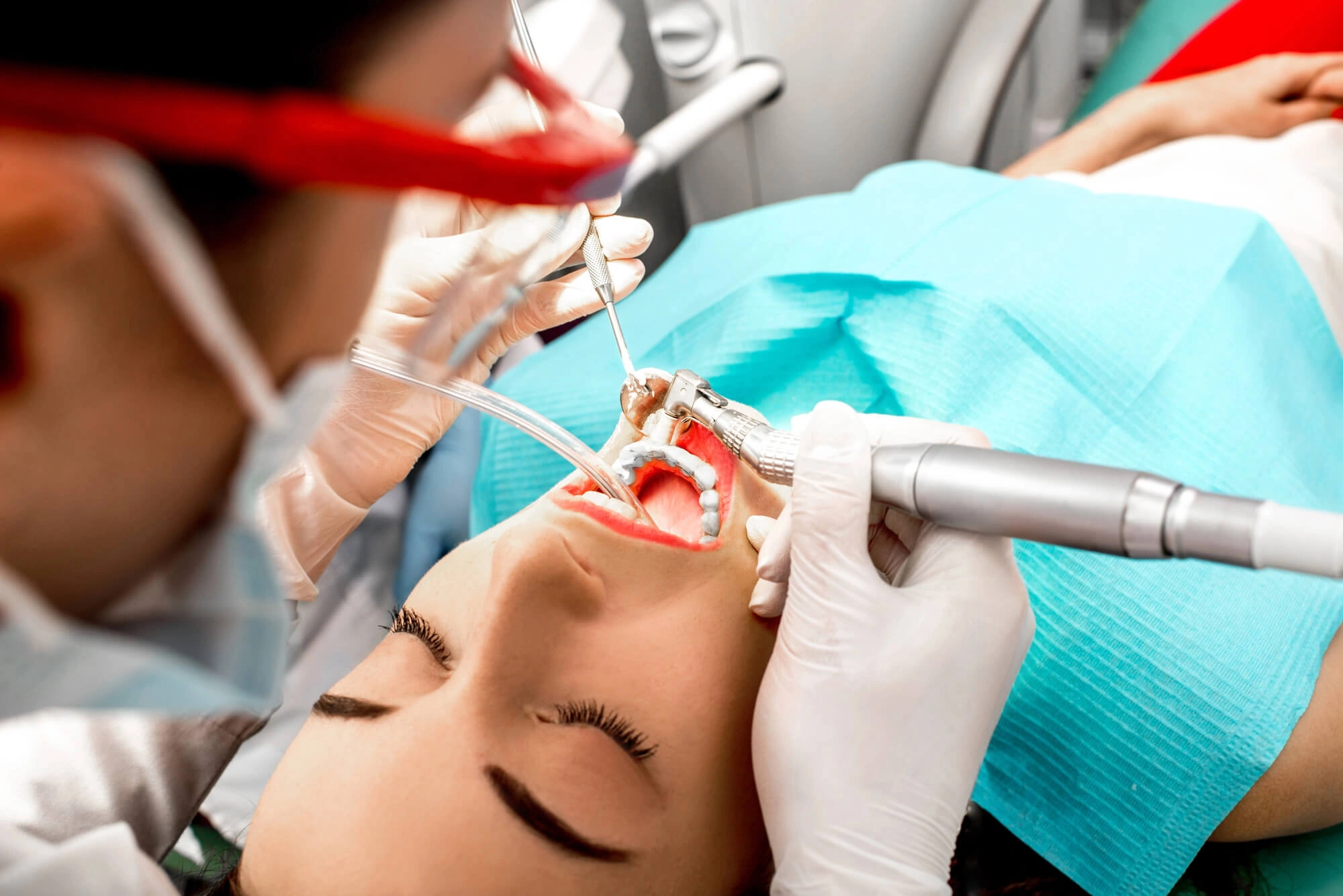 Davie teeth cleaning