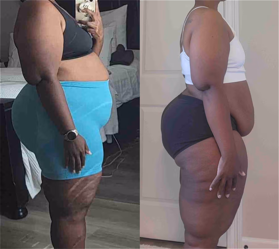 Black woman's side view of her body showing before and after difference after a fitness plan