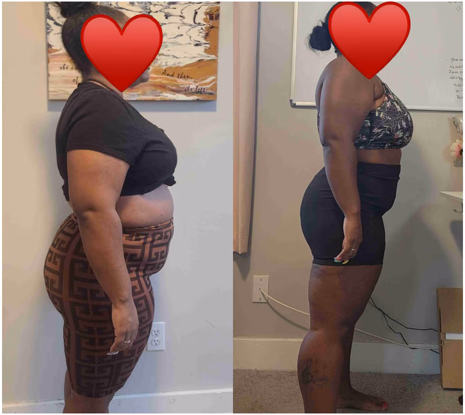 Black woman showing the right side of her torso before and after a fitness program