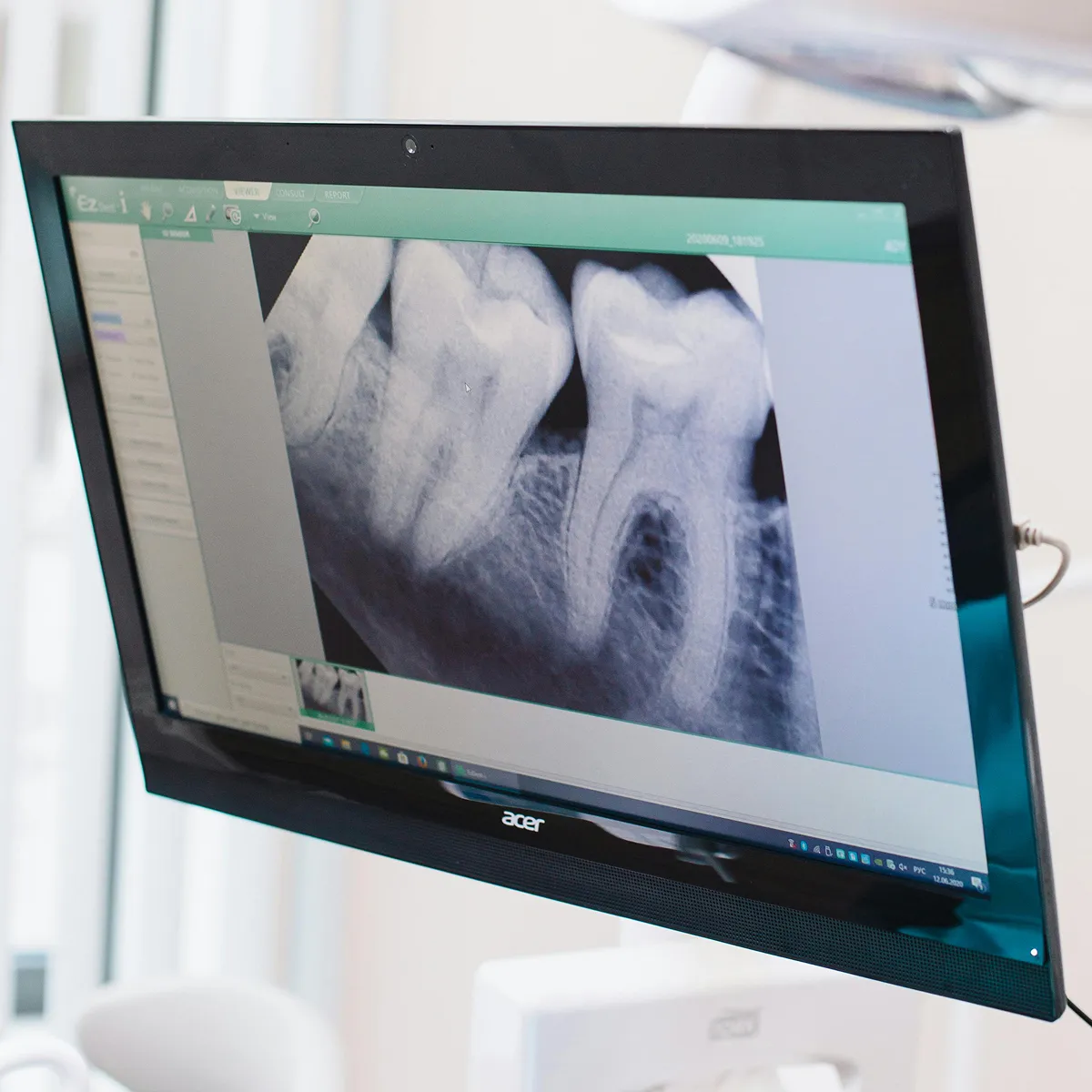 X-ray of teeth on the monitor at Concord Heritage Dental