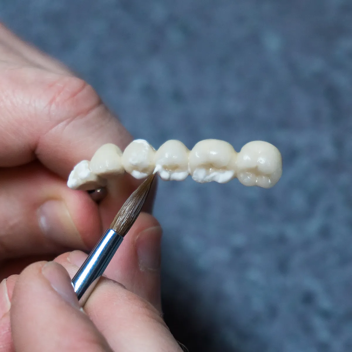 Crafting dental crowns at Concord Heritage Dental