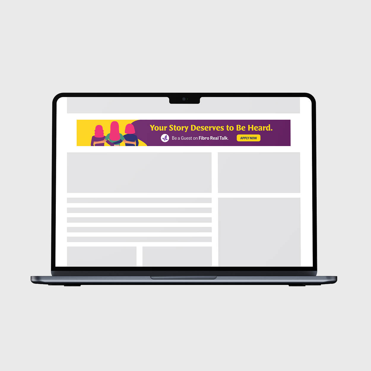 Laptop screen displaying a website with a banner stating, 'Your Story Deserves to Be Heard. Be a Guest on Fibro Real Talk.' with an Apply Now button.