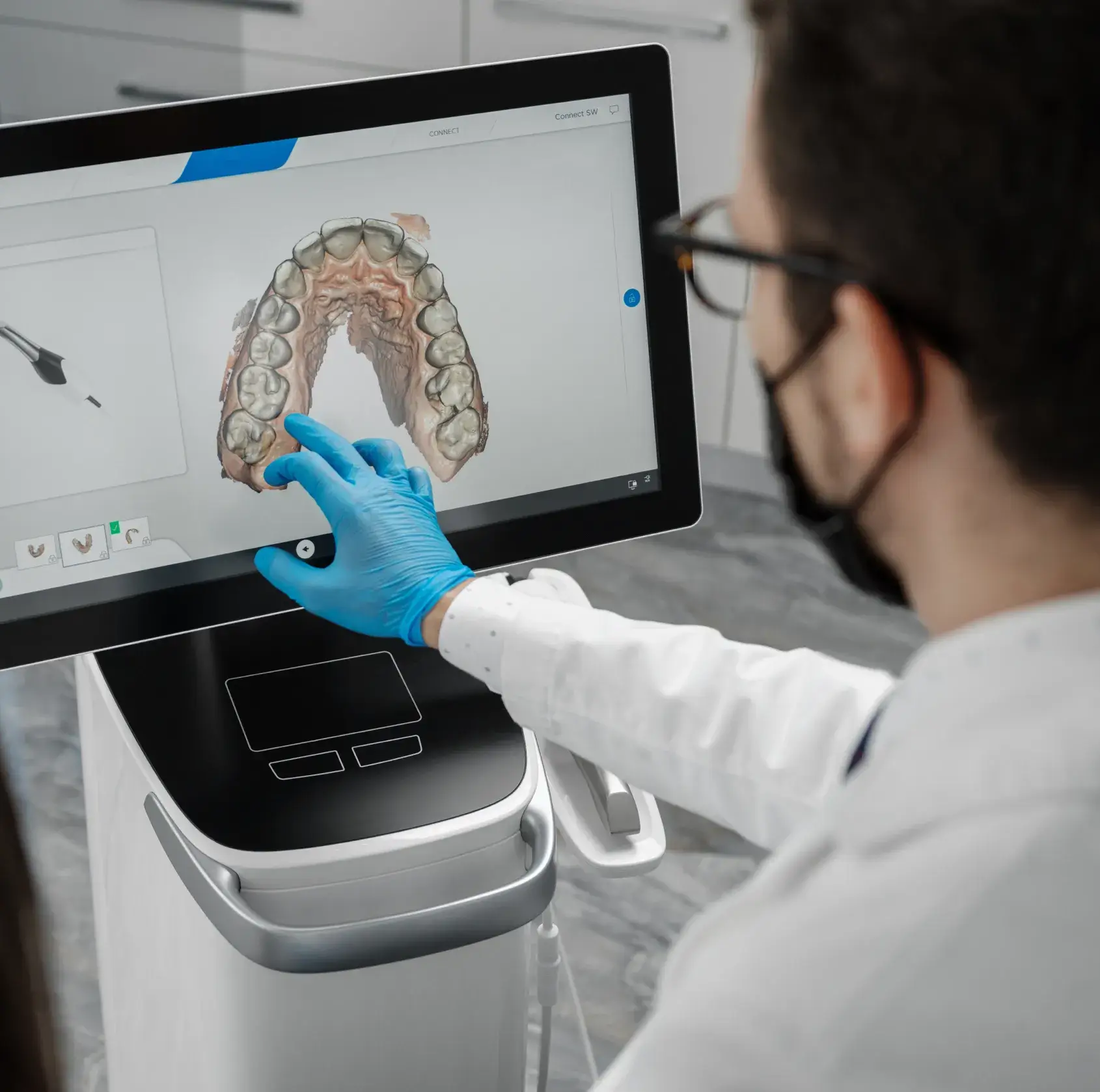 Person wearing blue gloves and a white coat using dental imaging software on a screen showing a 3D model of upper teeth and gums.
