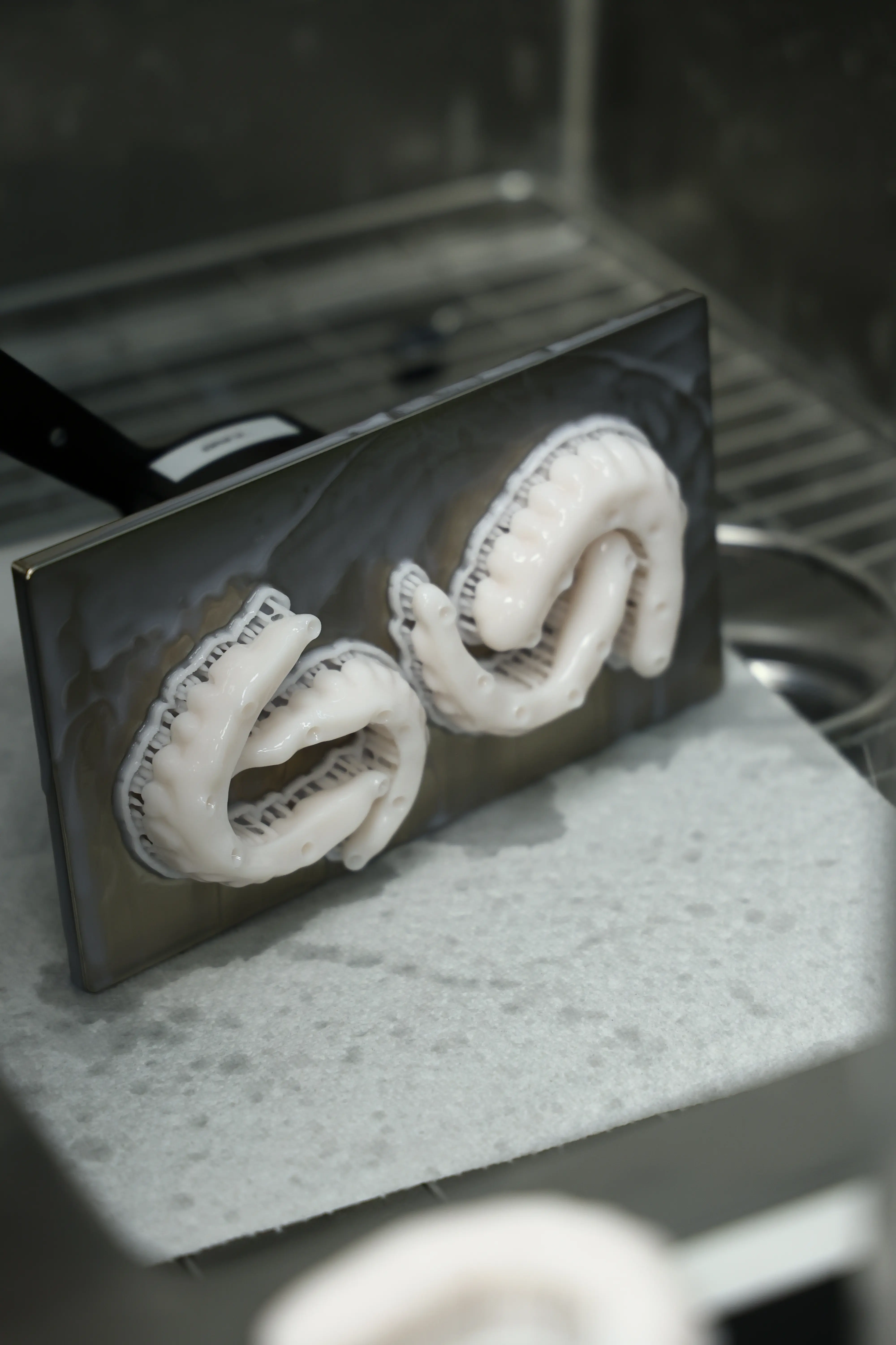 Testimonial from susan to kissimmee about dental implants