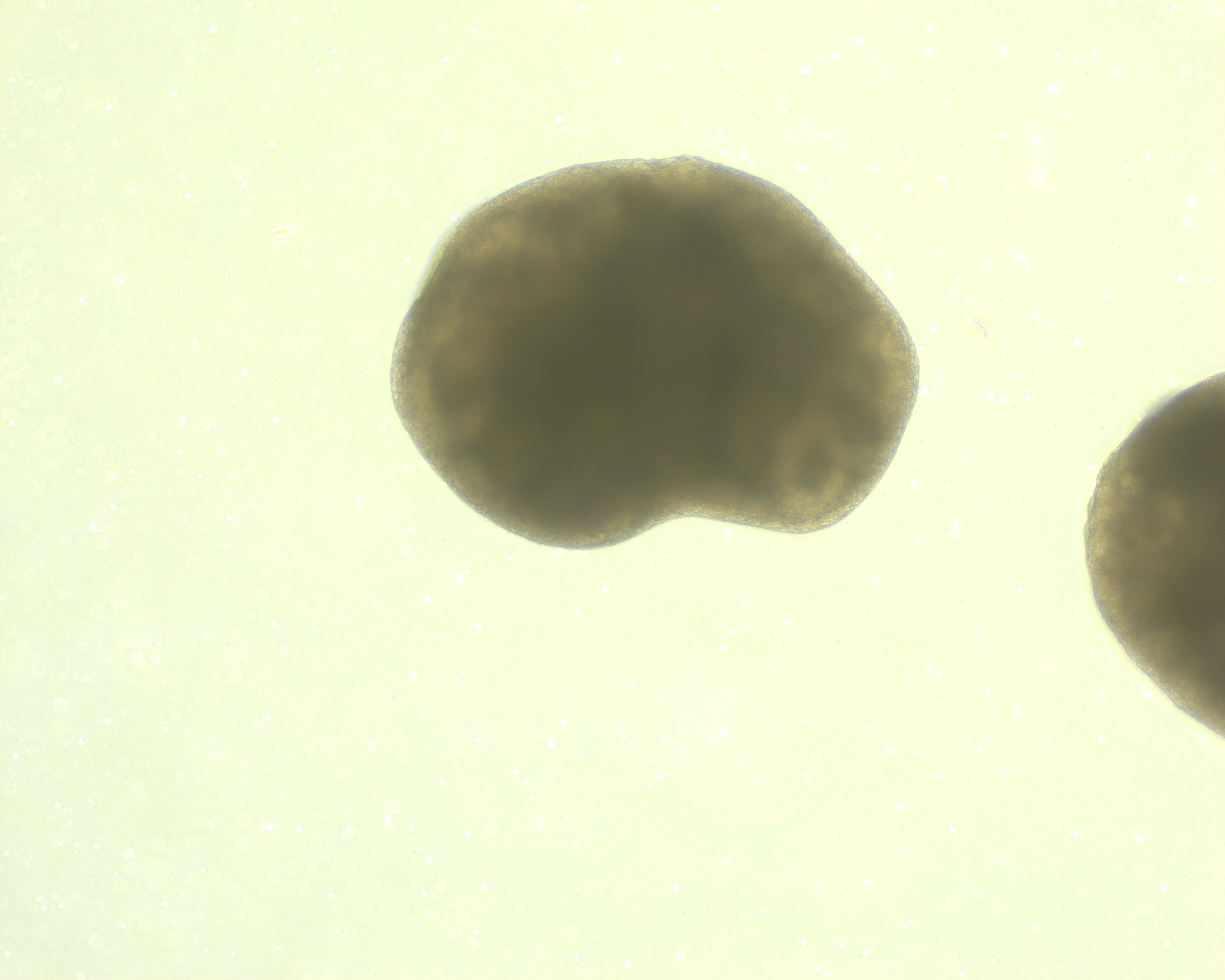 Cortex organoid, Day 20 brightfield
