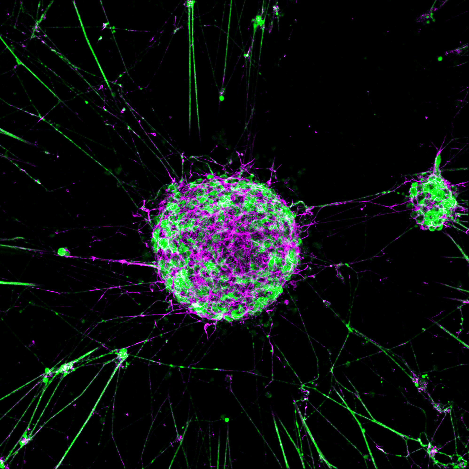 Spinal motor neurons, ChAT, actin, DAPI immunofluorescence