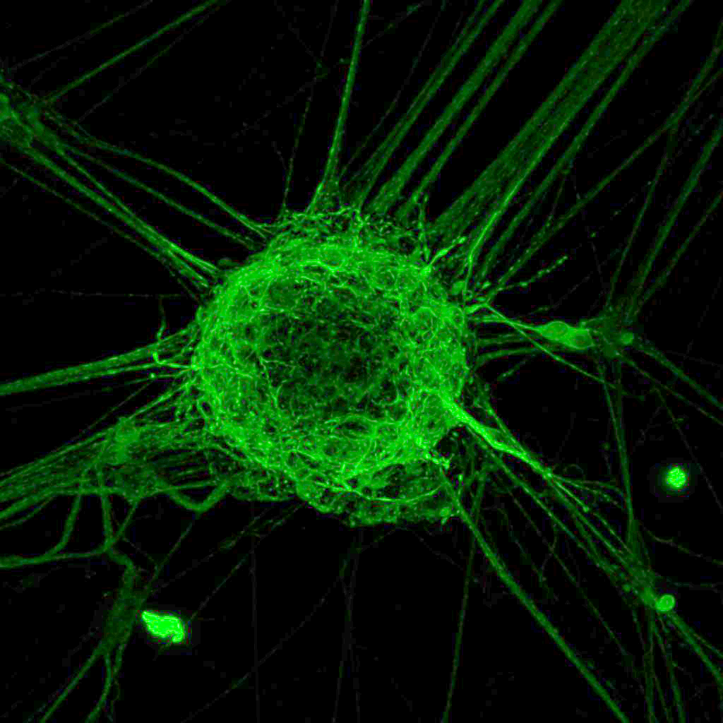 Spinal motor neurons, MAP2 immunofluorescence