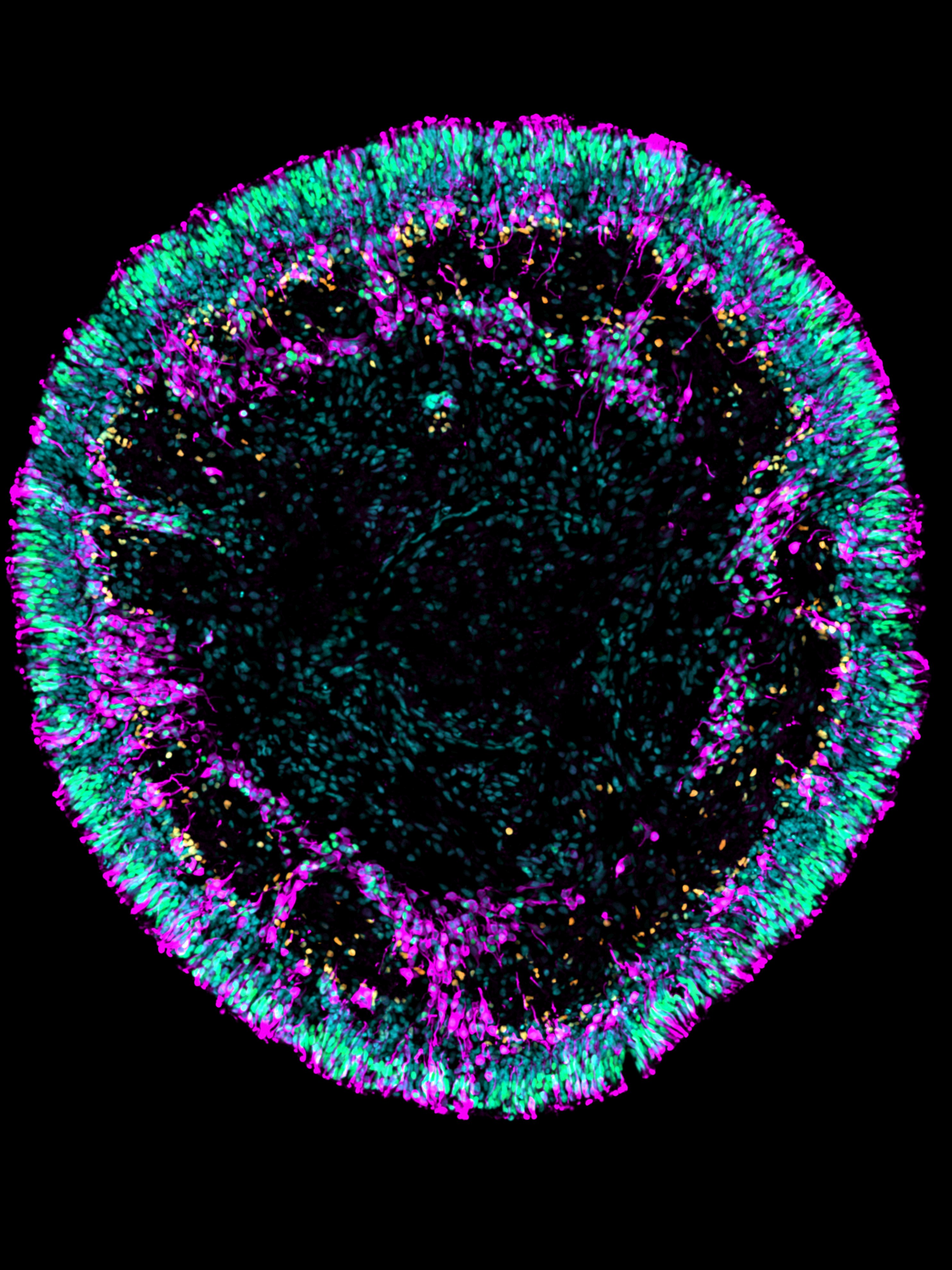 Retinal organoid immunofluorescence, cones, rods, amacrine cells