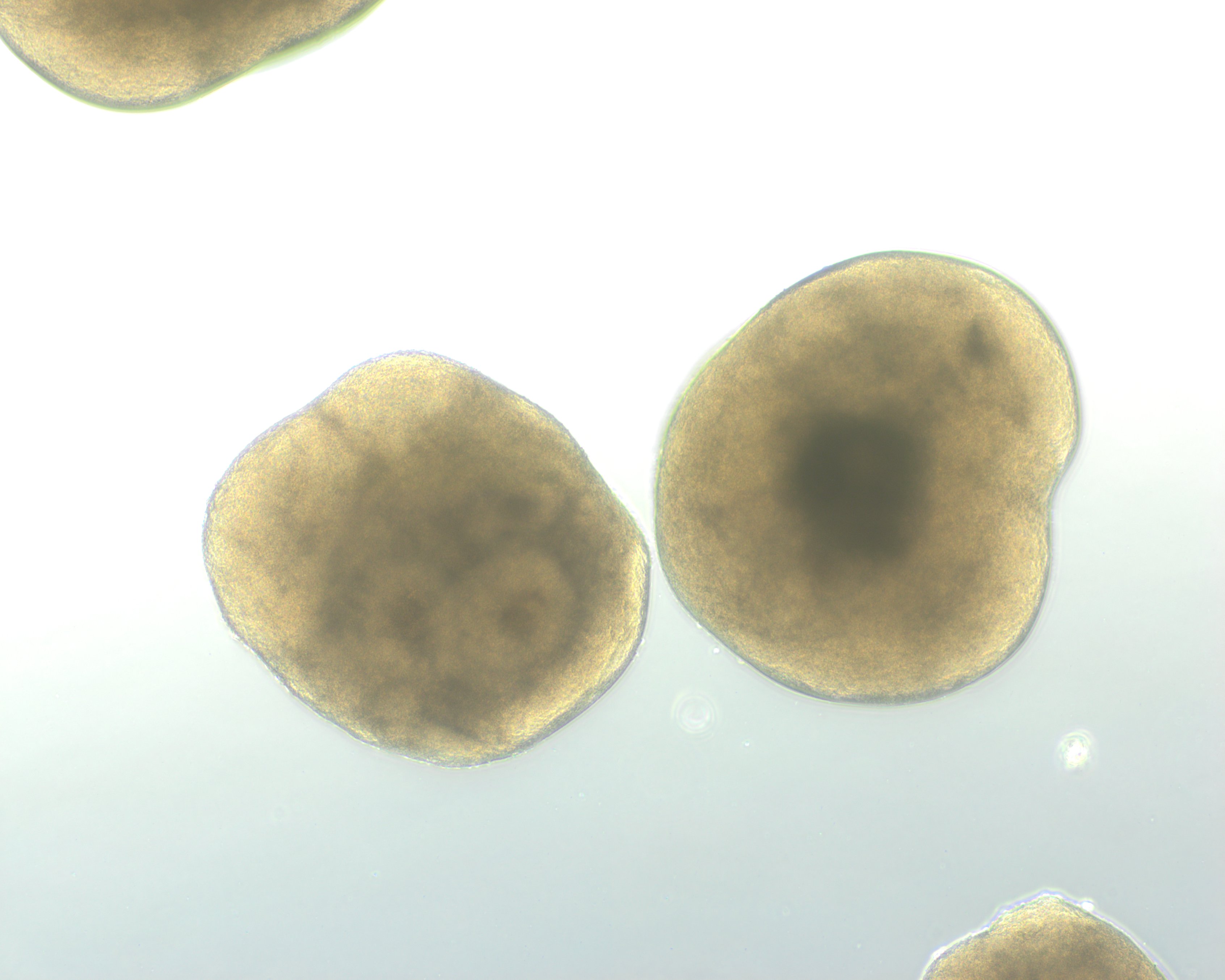 Hippocampus organoid, Day 20 brightfield
