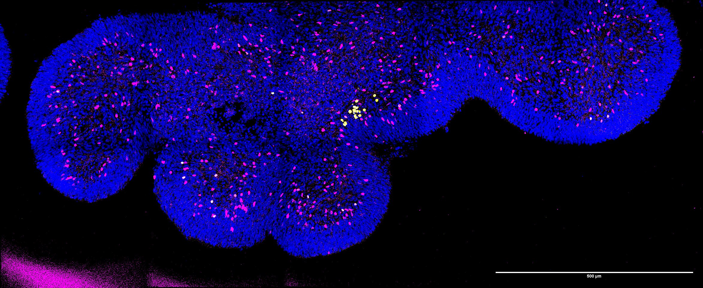 Spinal cord organoid, immunofluorescence