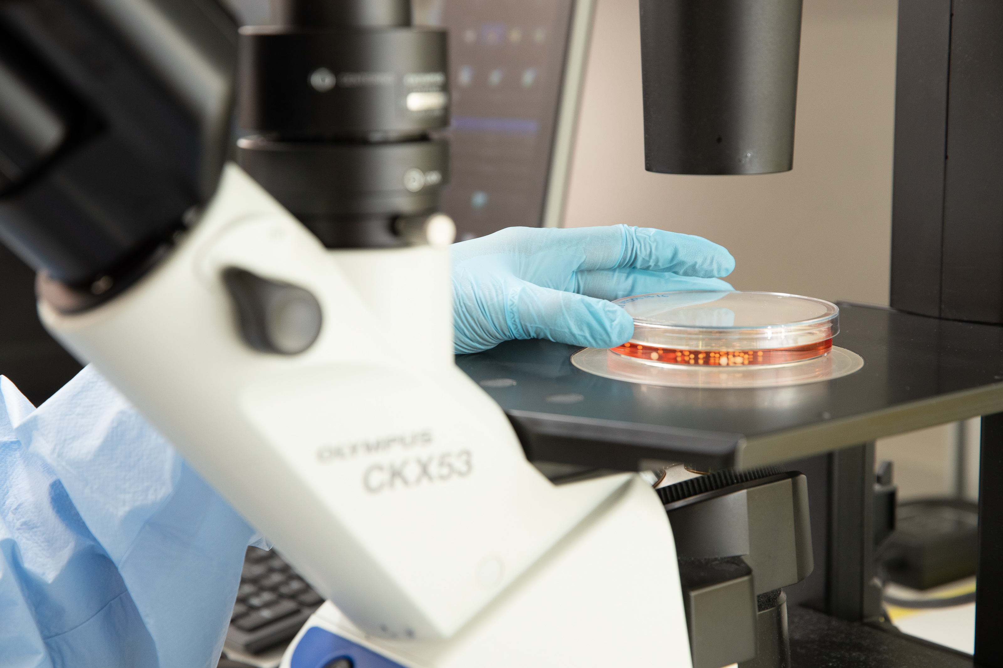 Organoid culture under the microscope in the Nocteva lab