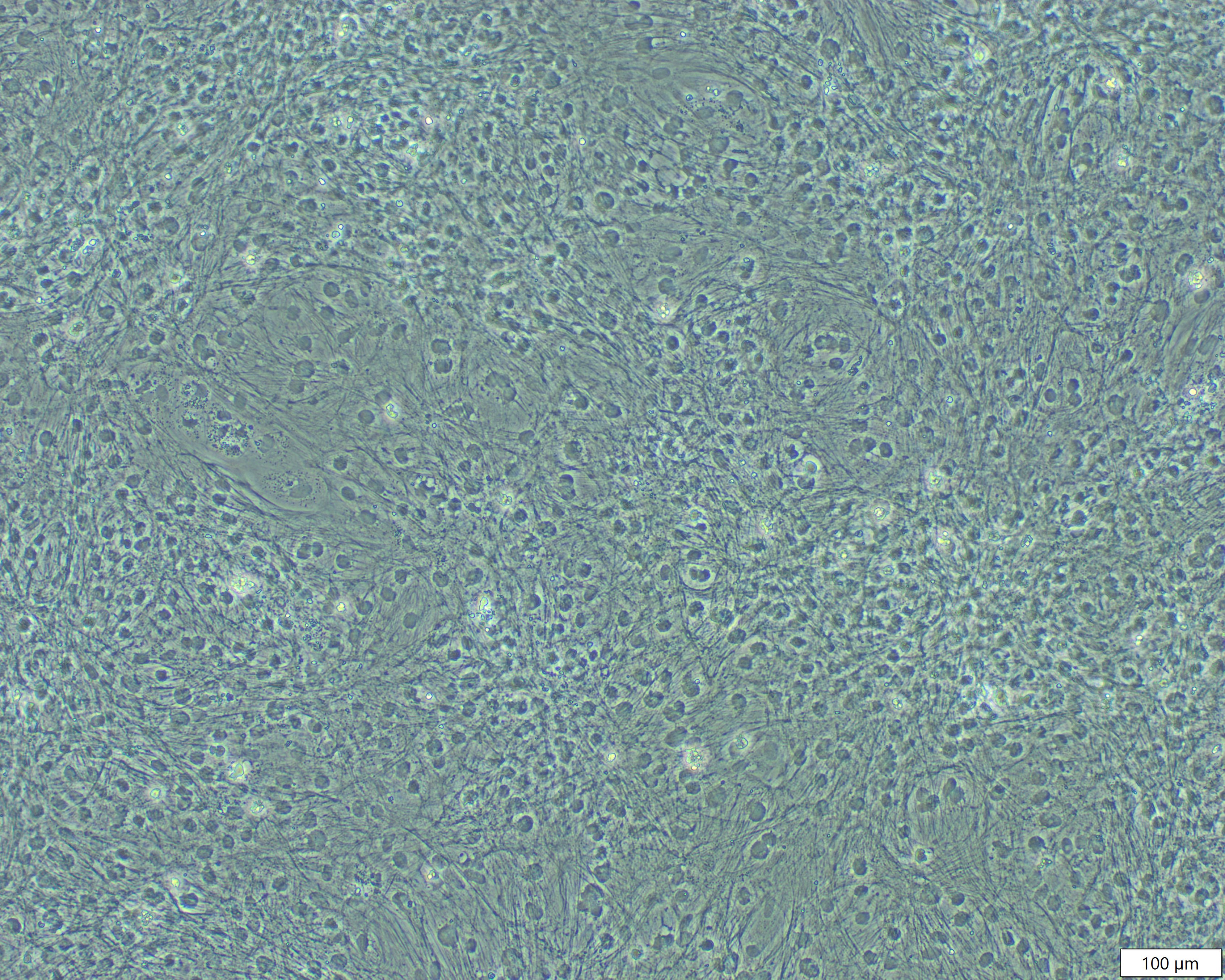 Cardiac monolayer, brightfield