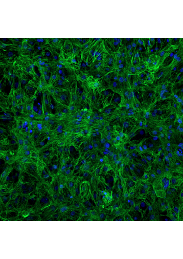 Cardiac monolayer, immunofluorescence