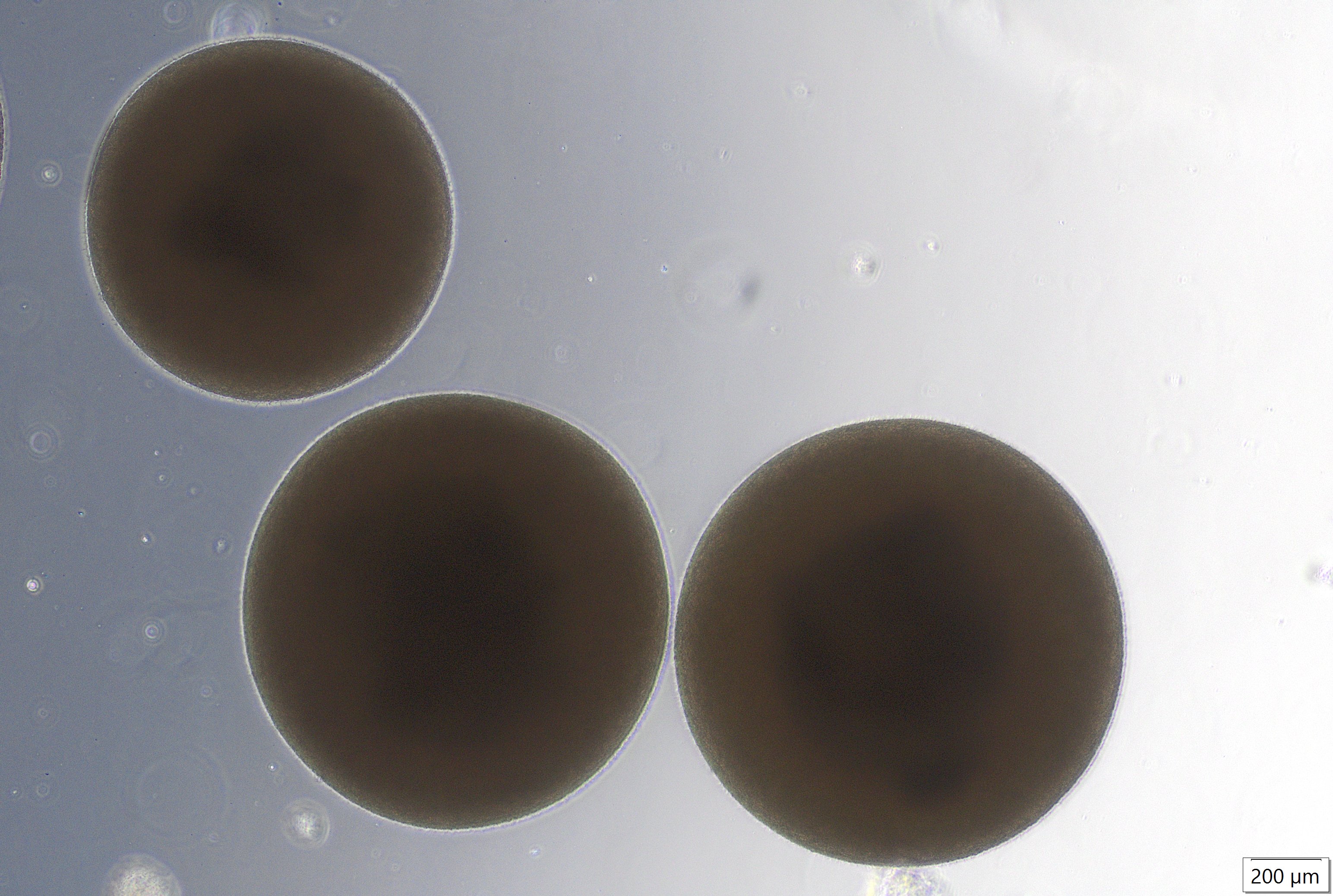 Glioblastoma organoid, brightfield, day 26