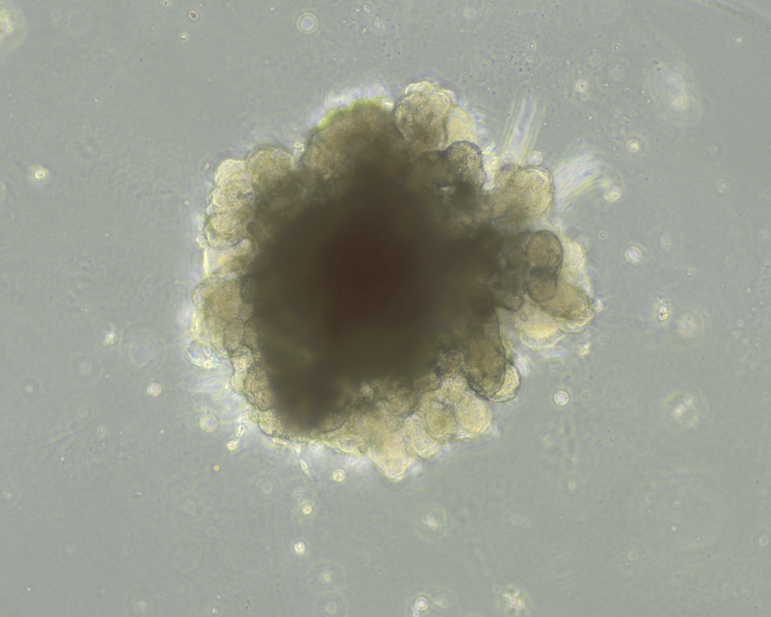 Lung organoids, brightfield
