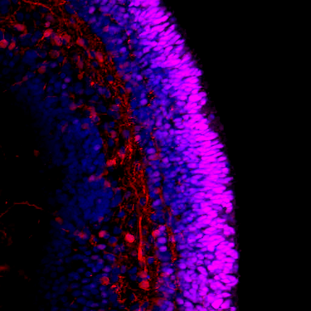 Retinal organoid, high magnification, Calretinin and CRX