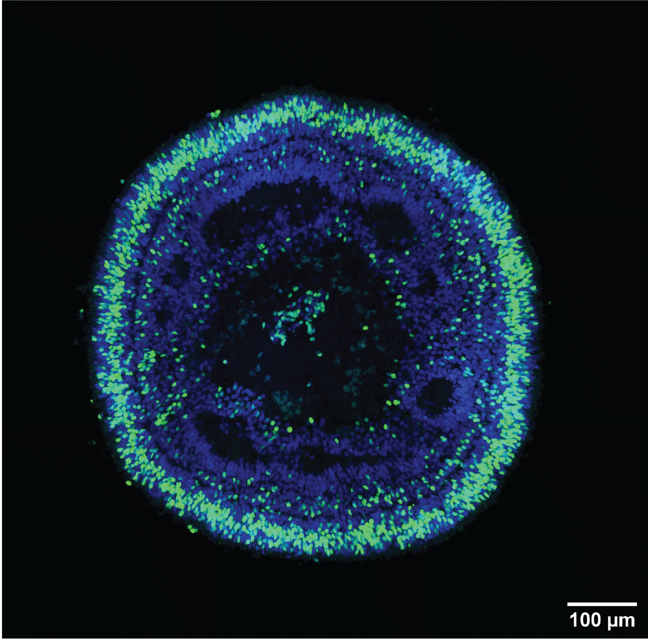 Retinal organoid, NRL-positive rod photoreceptors