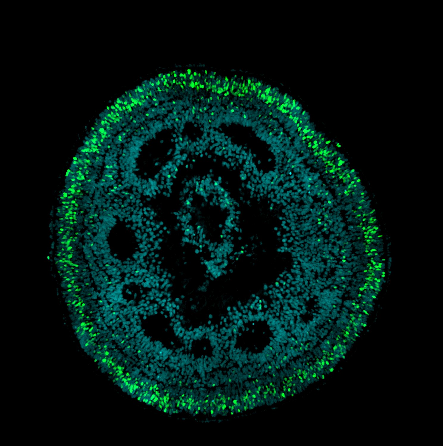Retinal organoid, NRL-positive rod photoreceptors